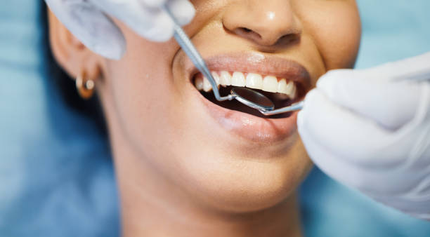 Best Broken Tooth Emergency  in Lakeland North, WA